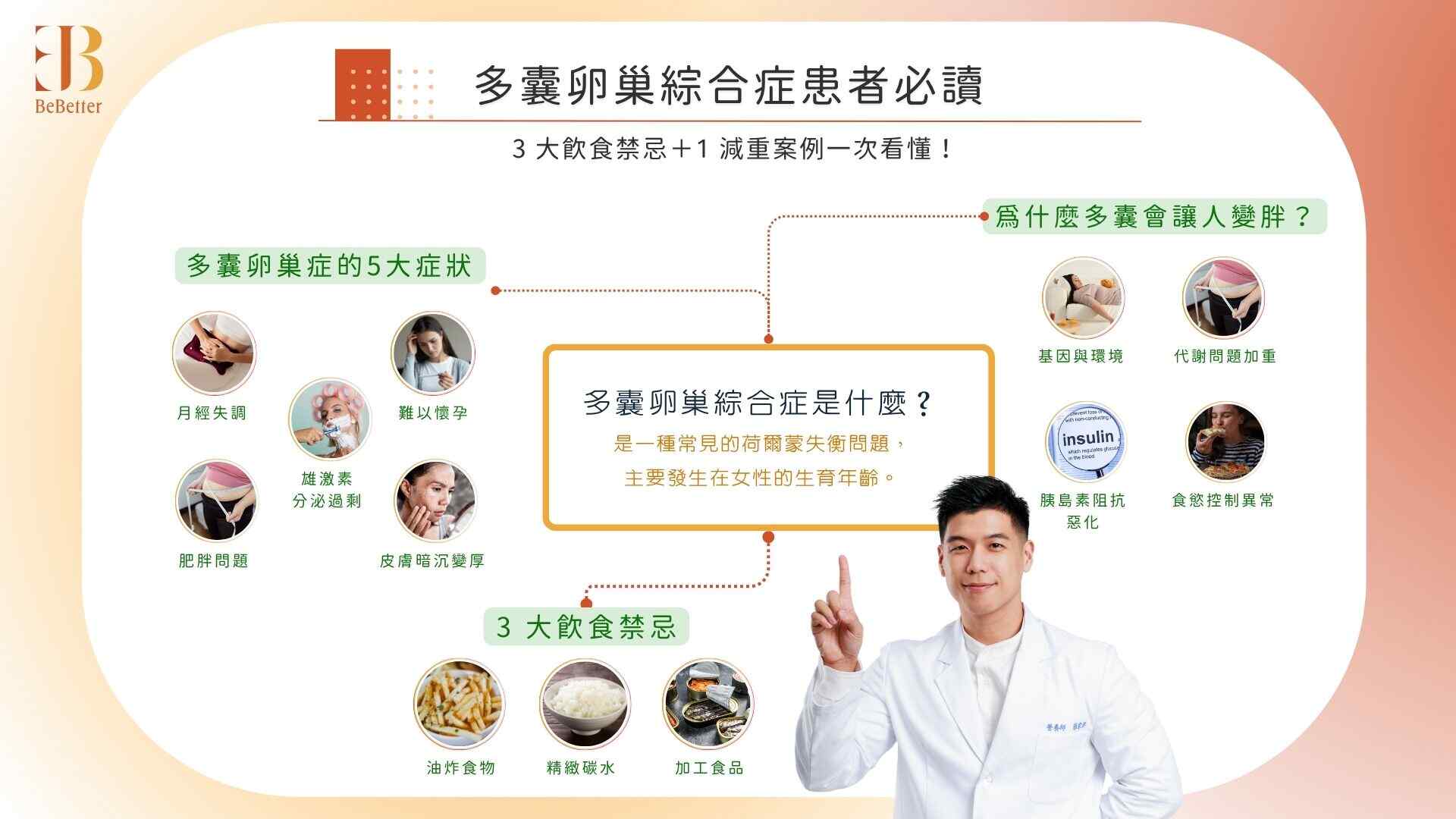 多囊卵巢綜合症