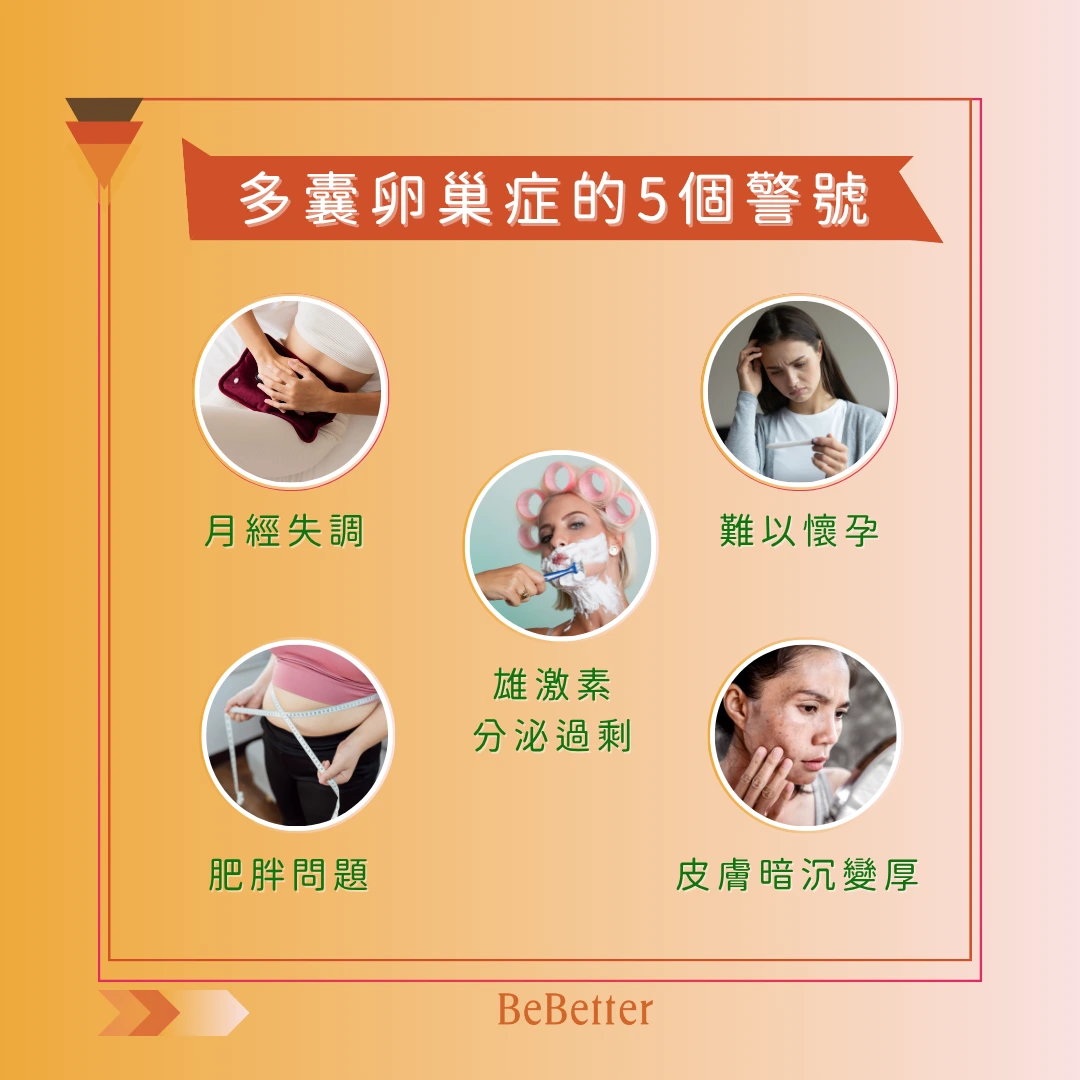 多囊卵巢症症狀